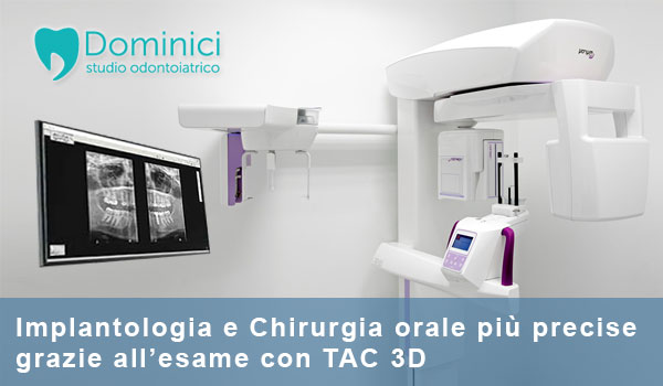 tac 3d studio dentistico roma studio odontoiatrico dominici eur