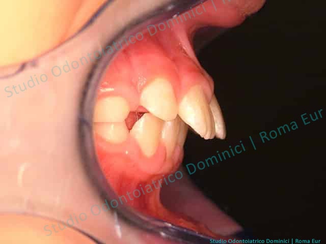 Ortodonzia Mobile  Studio Odontoiatrico Dominici - Studio Dentistico - Roma